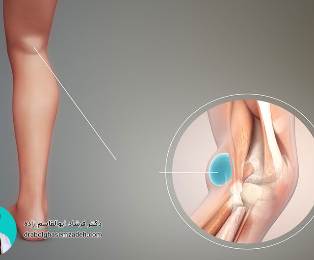 کیست بیکر چیست