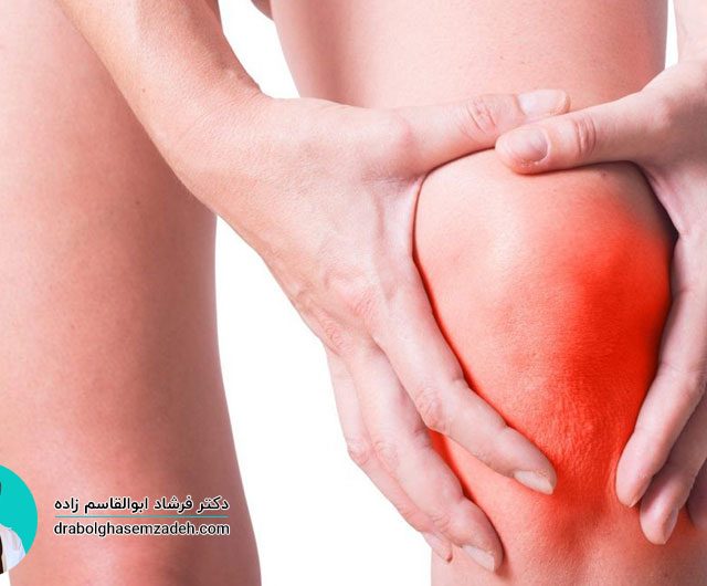 تاندونیت زانو یا التهاب تاندون زانو چیست؟