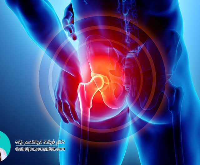 درمان روماتیسم لگن