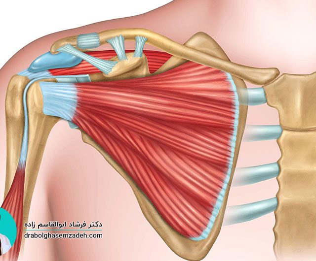 درمان پارگی لابروم شانه