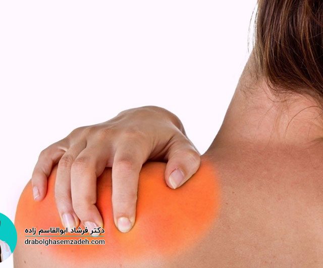 درمان پارگی کپسول مفصلی شانه