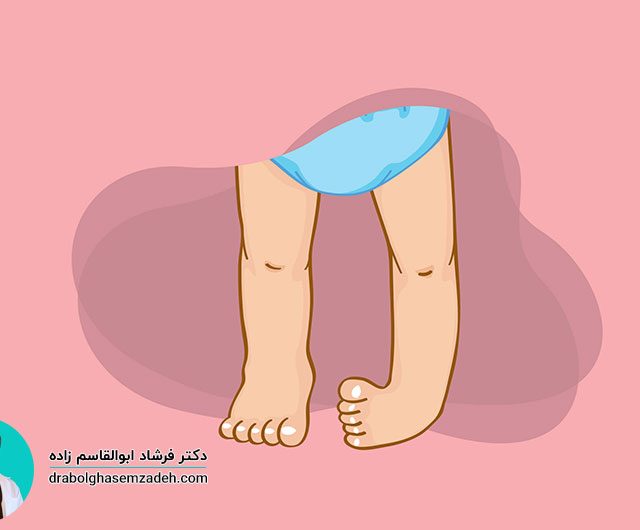 پاچنبری چیست و چگونه درمان می شود؟