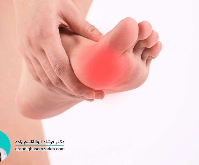 بیماری نورومای مورتون چیست و چه علائمی دارد؟