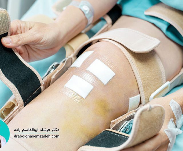 دلایل و علائم عفونت مفصل مصنوعی