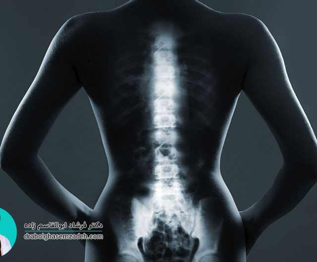 متاستاز استخوان چیست و چه علائمی دارد؟