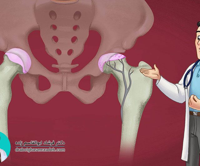 بیماری پرتس چیست؟