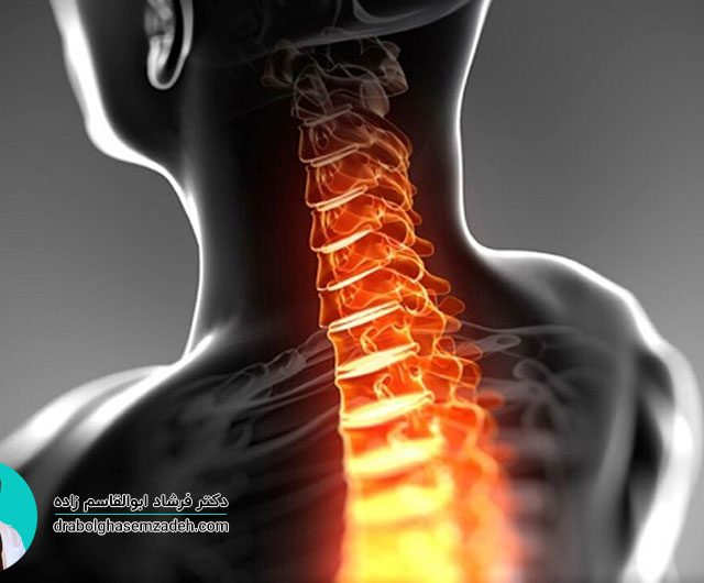 دیسک گردن و مشکلات آن
