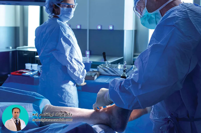 جراحی آرتروسکوپی مچ پا چیست؟