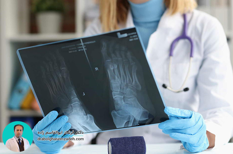 جراحی صافی کف پا چیست؟
