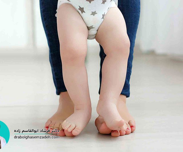 درمان پای پرانتزی