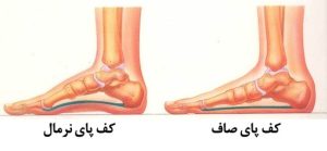 صافی کف پا