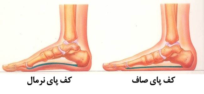 صافی کف پا